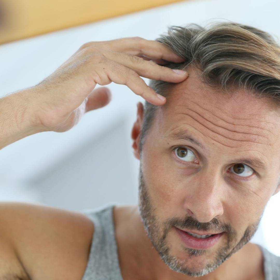 hair-transplant-a-permanent-solution-for-hair-loss-hair-transplant